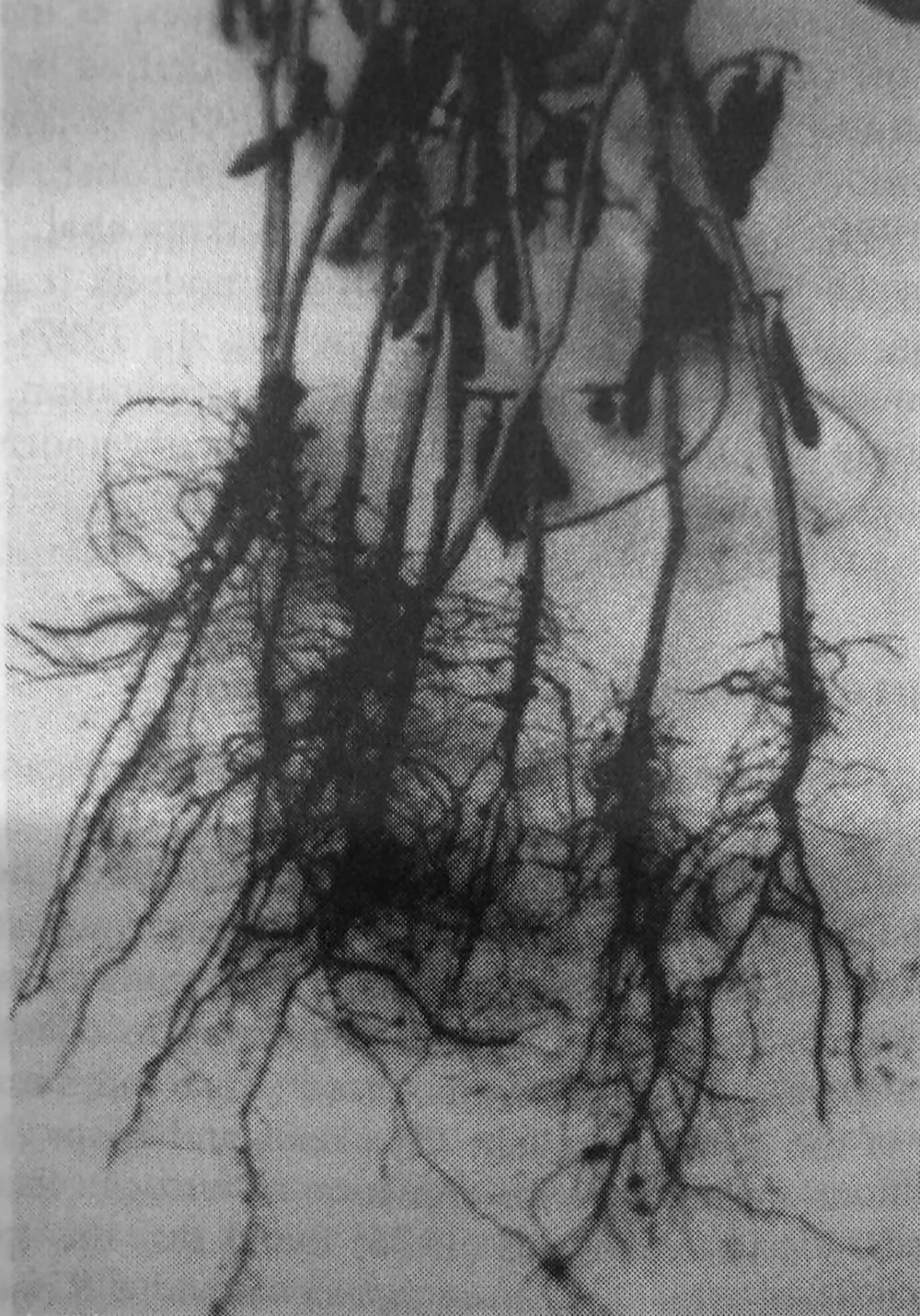 Image described by caption.