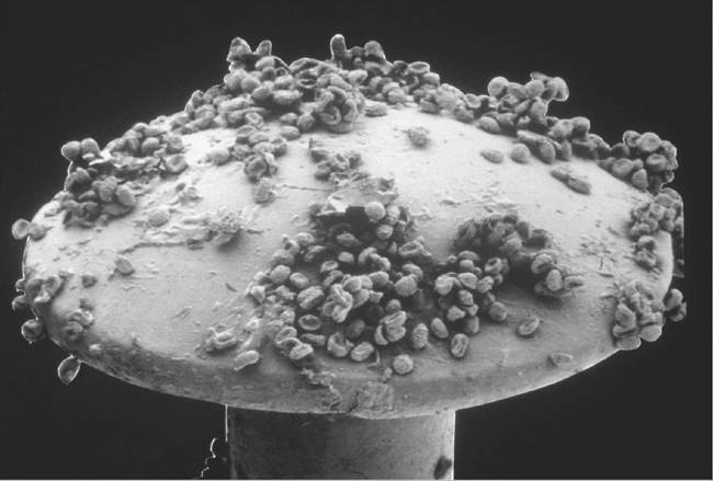 Roundworm eggs on the head of a pin. (Clouds Hill Imaging Ltd./Corbis)